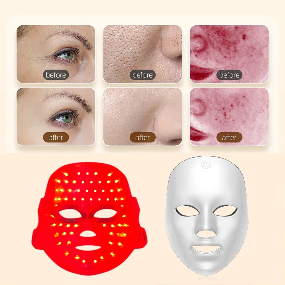 Glow Up LED Beauty Mask